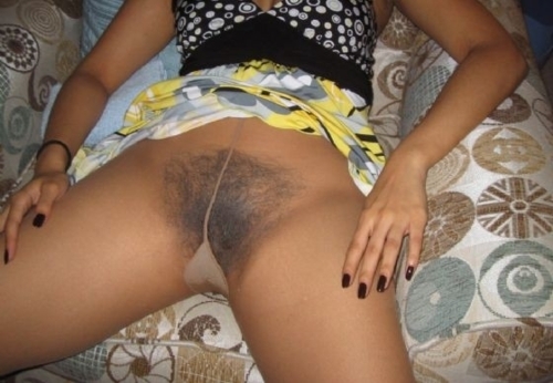 wtf; Hairy 